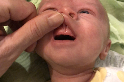 baby teeth dentist care